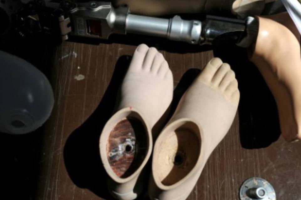 Trabalhadores podem usar FGTS para a compra de próteses e órteses