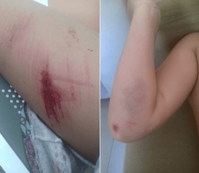 Mãe relata agressão de desconhecido à filha de oito anos