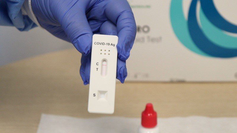 Estado destina testes de diagnóstico rápido da covid-19 para Caratinga e região