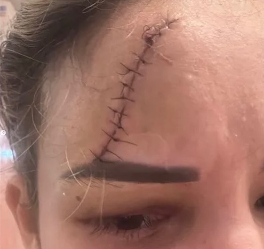 Juliana Ruas mandou foto para amiga em abril com ferimento na testa; advogado diz que médica era agredida pelo marido